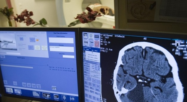 Stroke-hálózat néhány dunántúli kórházban: mesterséges intelligencia segíti a gyógyítást